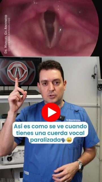 como se ve una cuerda vocal paralizada